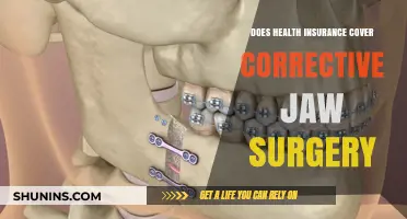 Does Health Insurance Cover Corrective Jaw Surgery? What You Need to Know