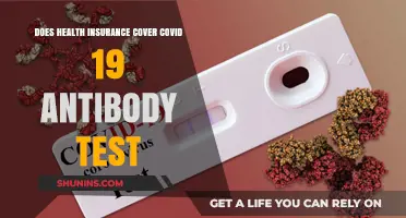 Does Health Insurance Cover COVID-19 Antibody Testing? Find Out Here