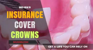 Does Health Insurance Cover Crowns? Understanding Dental Coverage and Costs