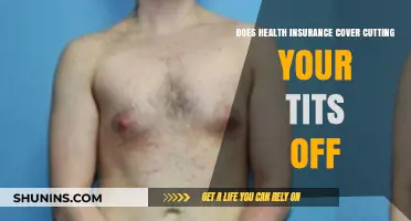 Does Health Insurance Cover Gender-Affirming Mastectomies? A Guide