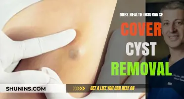 Does Health Insurance Cover Cyst Removal? What You Need to Know