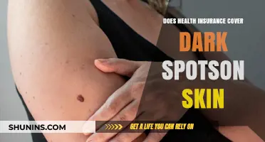 Does Health Insurance Cover Dark Spots on Skin? What to Know