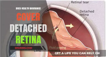 Does Health Insurance Cover Detached Retina? What You Need to Know