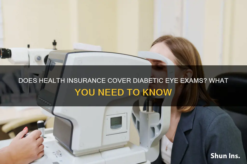 does health insurance cover diabetic eye exam