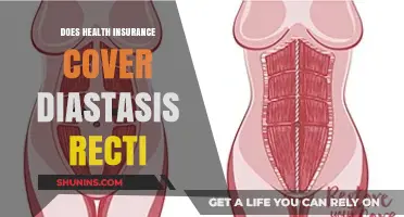 Does Health Insurance Cover Diastasis Recti? What You Need to Know