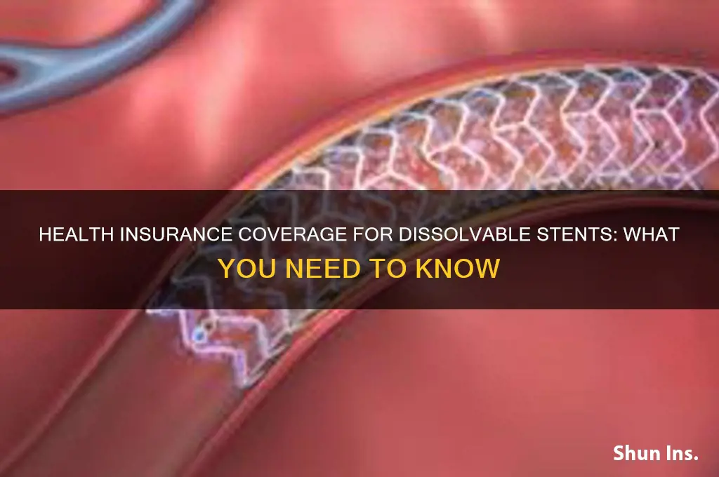 does health insurance cover disovable stents