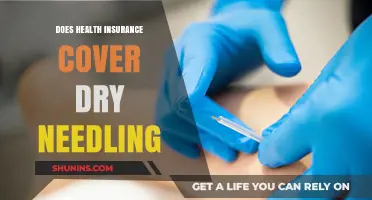Does Health Insurance Cover Dry Needling? What You Need to Know