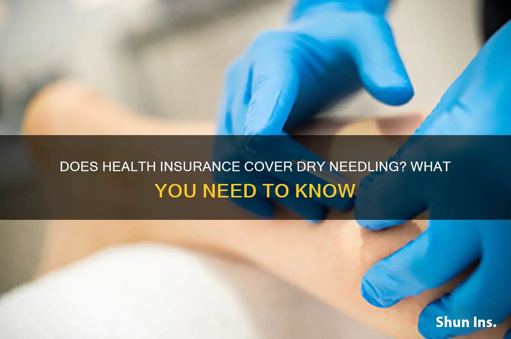does health insurance cover dry needling