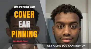 Does Health Insurance Cover Ear Pinning? What You Need to Know