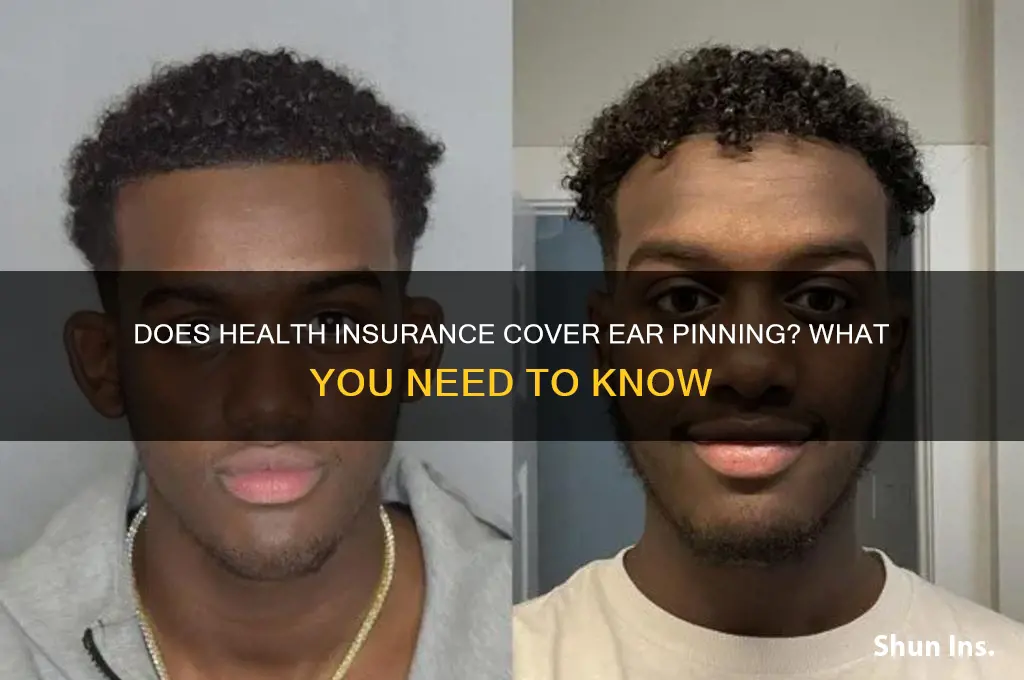 does health insurance cover ear pinning