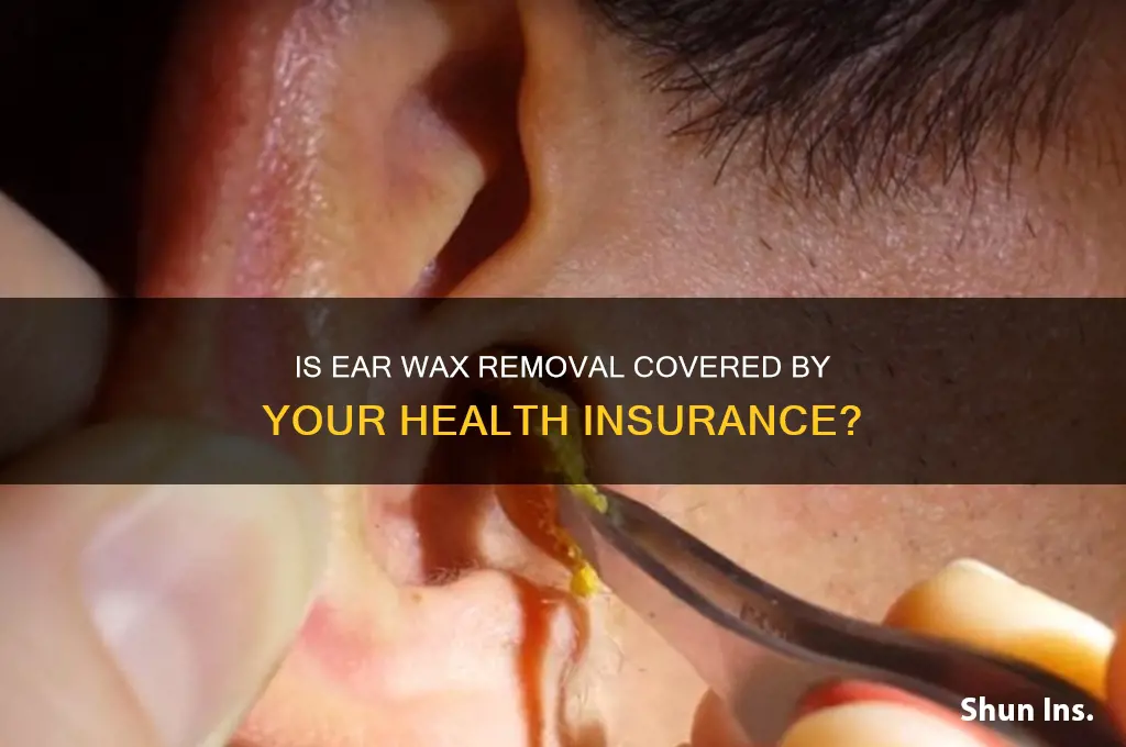 does health insurance cover ear wax removal