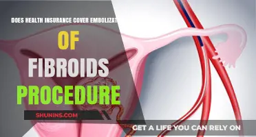Does Health Insurance Cover Uterine Fibroid Embolization? What to Know