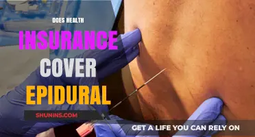 Does Health Insurance Cover Epidural? Understanding Your Coverage Options