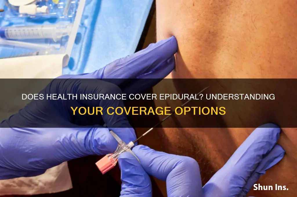 does health insurance cover epidural
