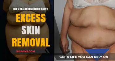 Does Health Insurance Cover Excess Skin Removal After Weight Loss?