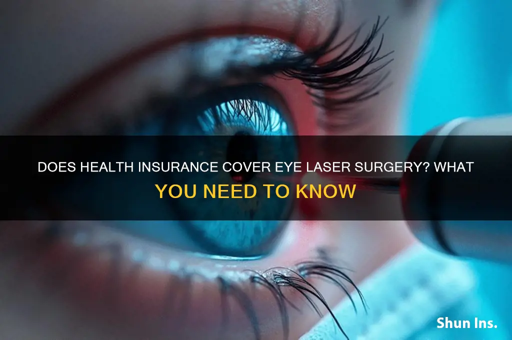 does health insurance cover eye laser surgery
