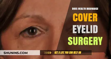 Does Health Insurance Cover Eyelid Surgery? What You Need to Know