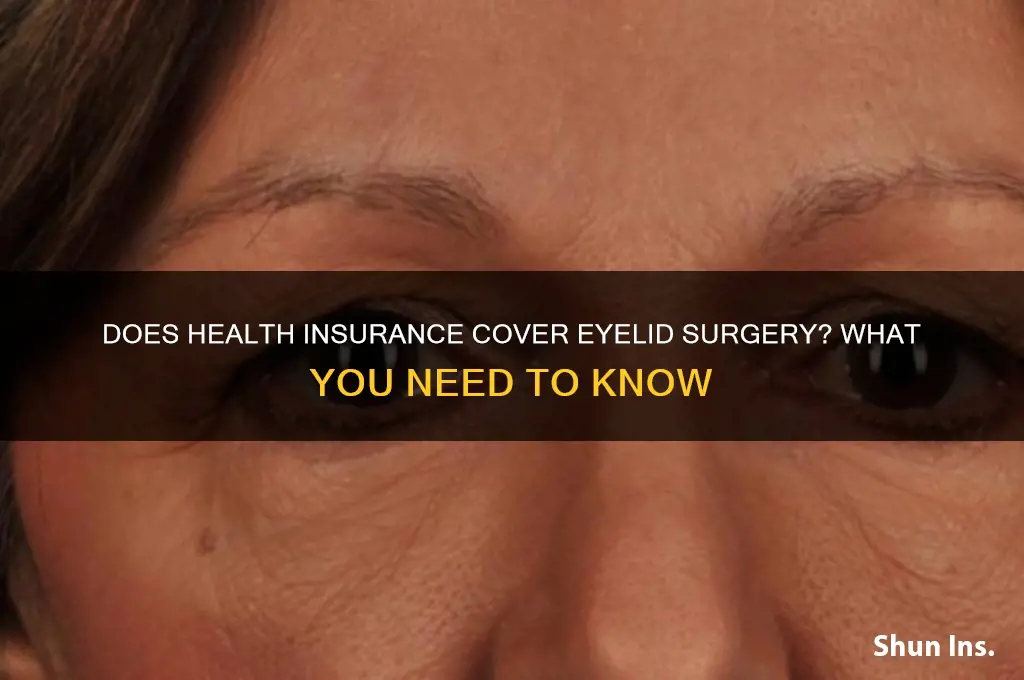 does health insurance cover eyelid surgery