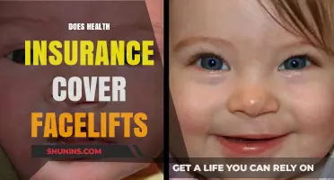 Does Health Insurance Cover Facelifts? What You Need to Know