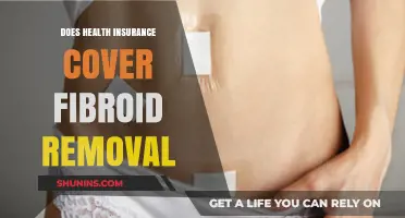 Does Health Insurance Cover Fibroid Removal? What You Need to Know