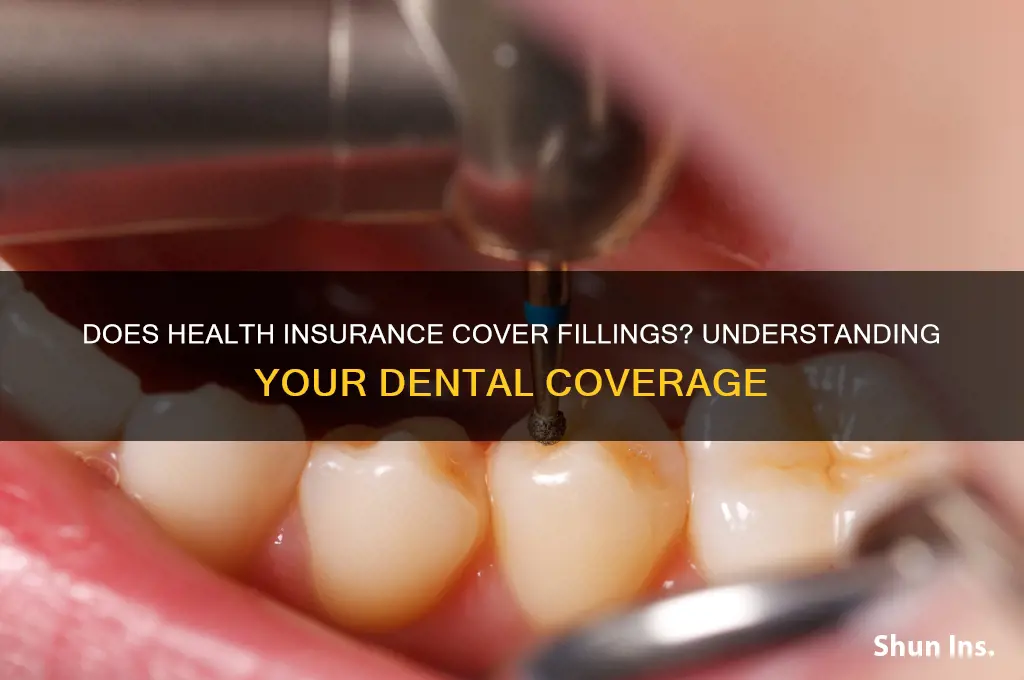 does health insurance cover fillings