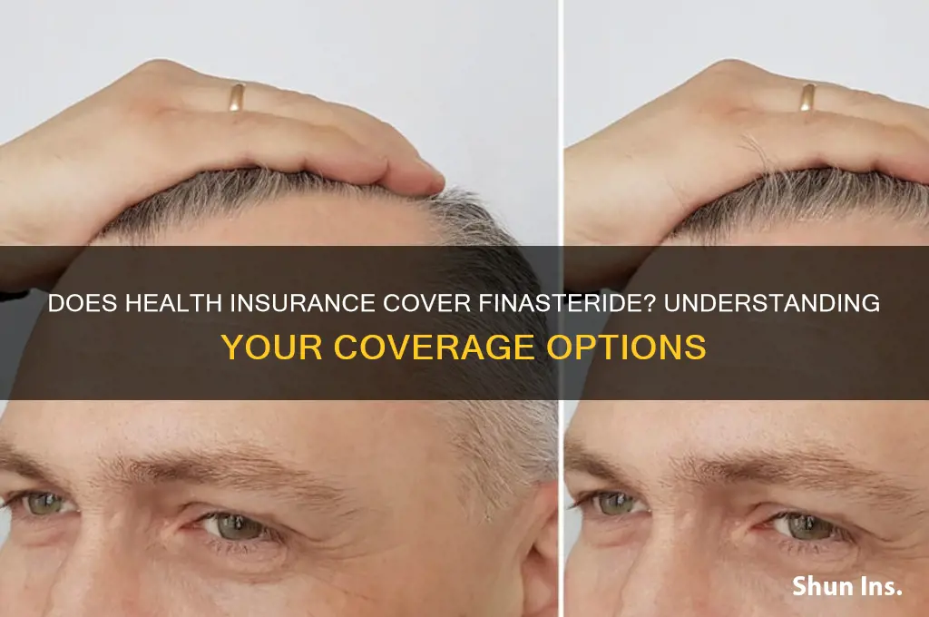 does health insurance cover finasteride