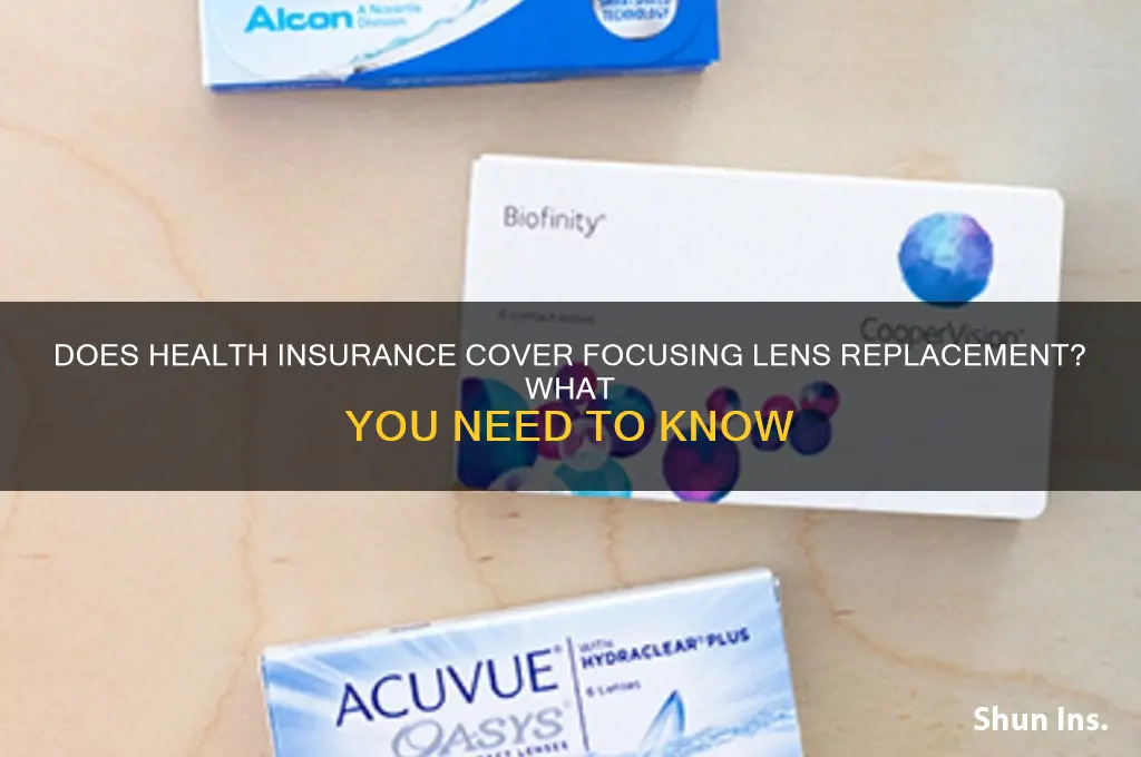 does health insurance cover focusing lens replacement