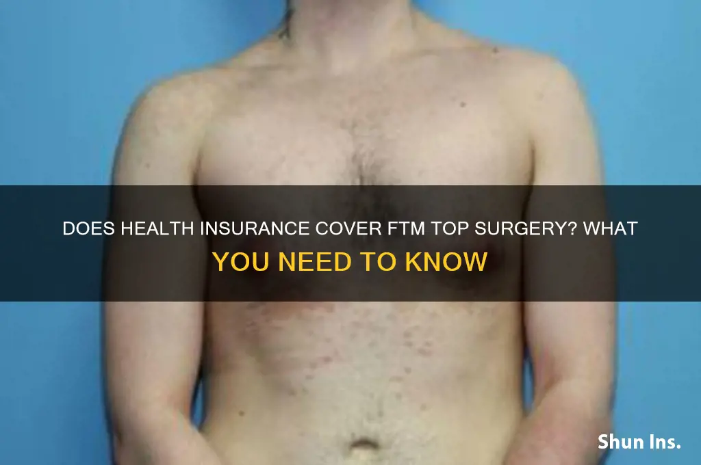 does health insurance cover ftm top surgery