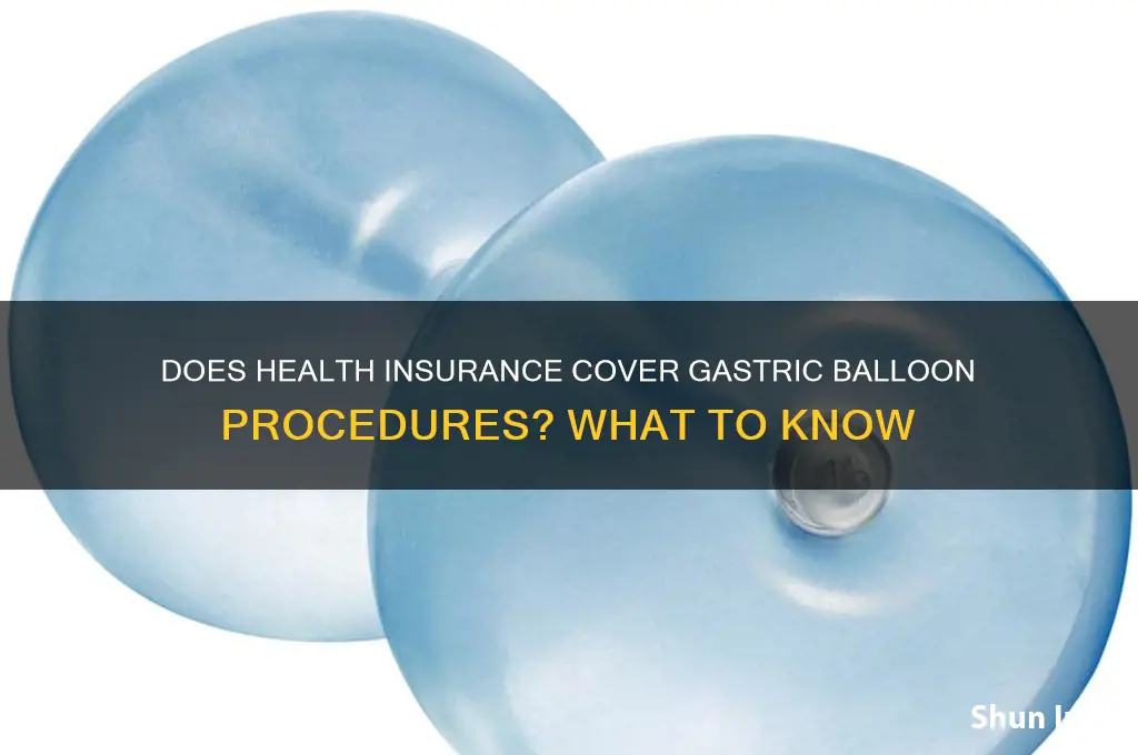 does health insurance cover gastric balloon