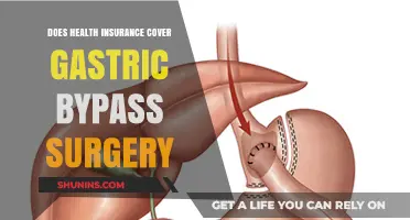 Does Health Insurance Cover Gastric Bypass Surgery? What You Need to Know