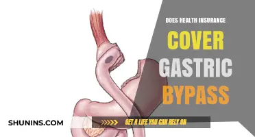 Does Health Insurance Cover Gastric Bypass? What You Need to Know