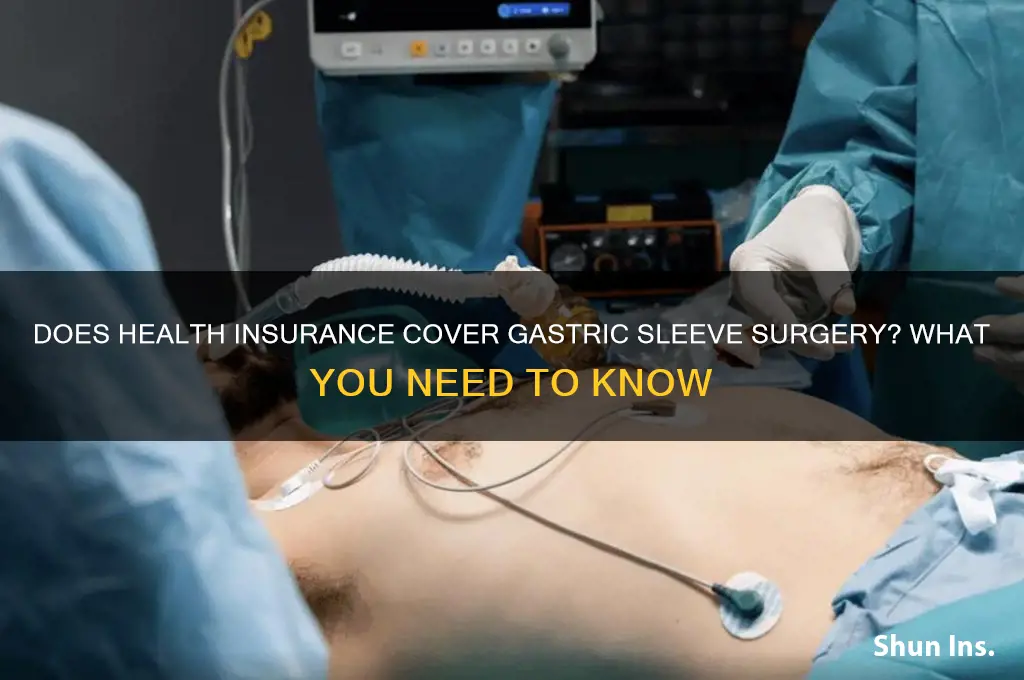 does health insurance cover gastric sleeve