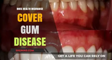 Does Health Insurance Cover Gum Disease? What You Need to Know