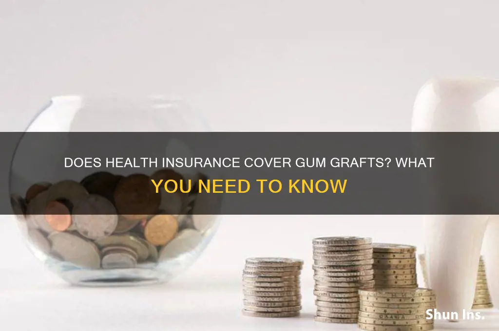 does health insurance cover gum grafts