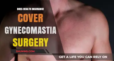 Does Health Insurance Cover Gynecomastia Surgery? What You Need to Know