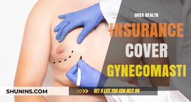 Does Health Insurance Cover Gynecomastia? Understanding Coverage and Costs
