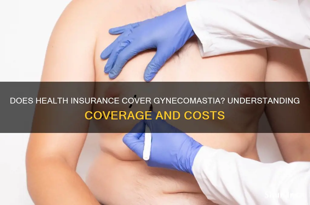does health insurance cover gynecomastia