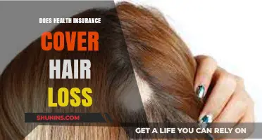Does Health Insurance Cover Hair Loss? What You Need to Know