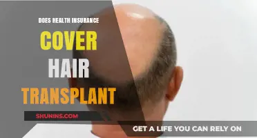 Does Health Insurance Cover Hair Transplants? What You Need to Know