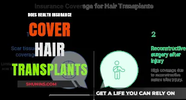 Does Health Insurance Cover Hair Transplants? What You Need to Know