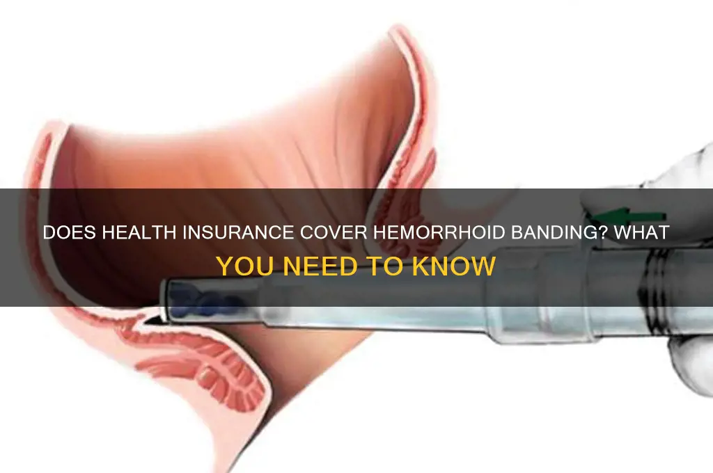 does health insurance cover hemorrhoid banding