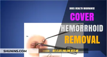Does Health Insurance Cover Hemorrhoid Removal? What You Need to Know