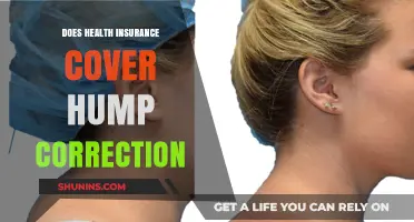 Does Health Insurance Cover Hump Correction? What You Need to Know