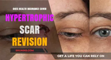 Health Insurance Coverage for Hypertrophic Scar Revision: What You Need to Know