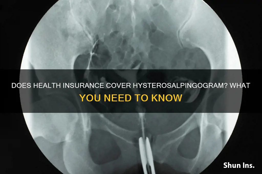 does health insurance cover hysterosalpingogram