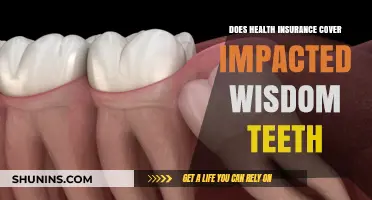 Does Health Insurance Cover Impacted Wisdom Teeth Removal?
