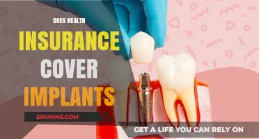 Does Health Insurance Cover Implants? A Comprehensive Guide to Coverage