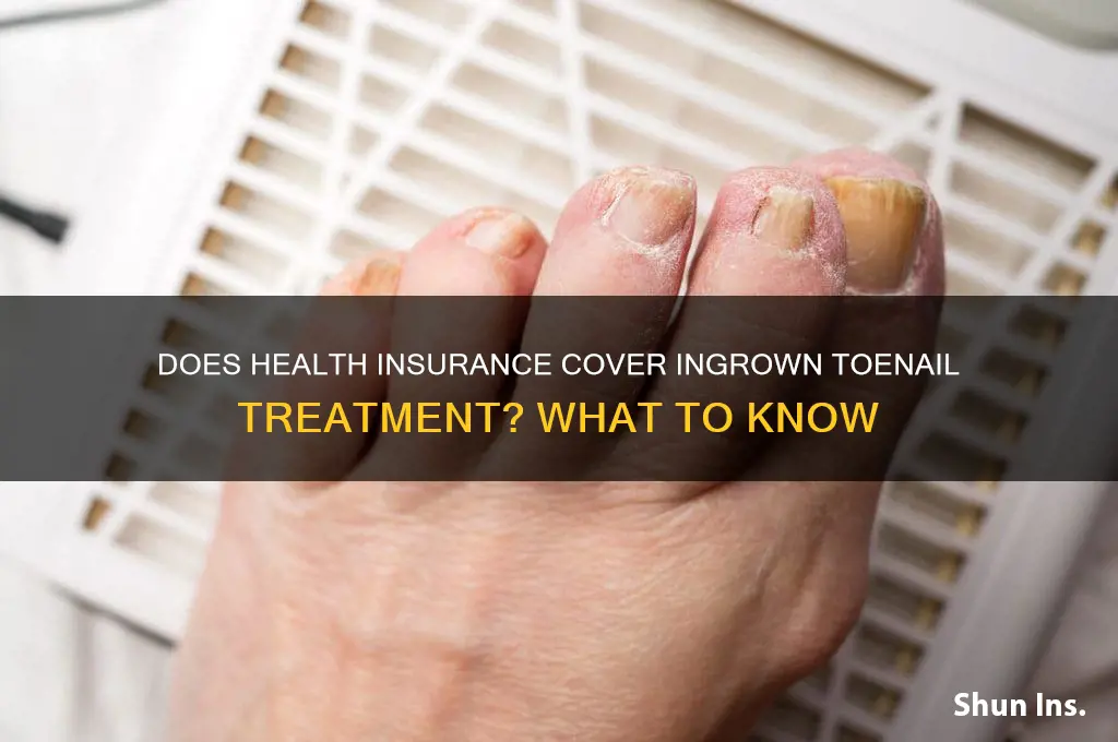 does health insurance cover ingrown toenails