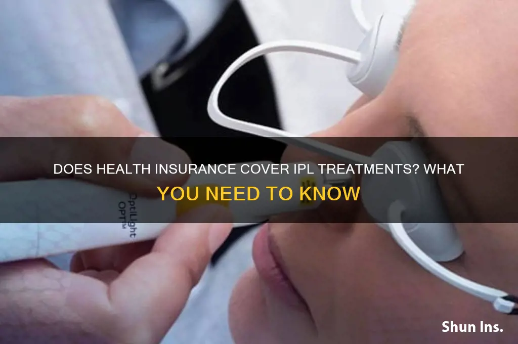 does health insurance cover ipl