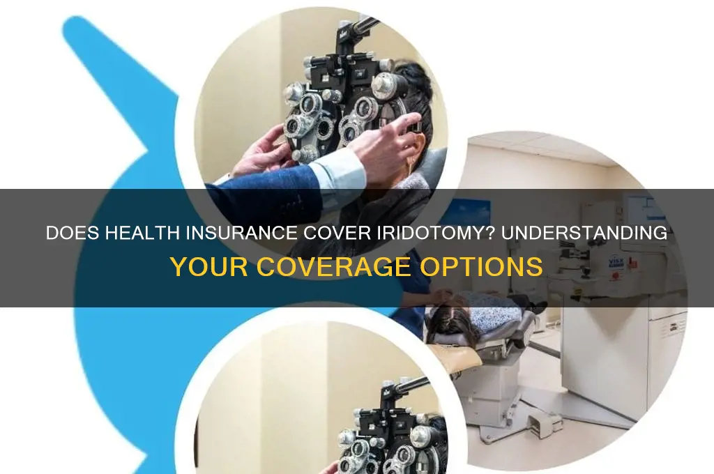 does health insurance cover iridotomy